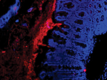Imagen: Células intestinales (azules) cubiertas con una capa muy gruesa y densa de bacterias (rojo) (Fotografía cortesía del Dr. Li Hai, Universidad de Berna). Imagen: Células intestinales (azules) cubiertas con una capa muy gruesa y densa de bacterias (rojo) (Fotografía cortesía del Dr. Li Hai, Universidad de Berna).